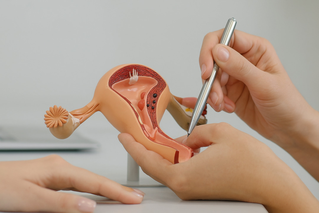 Vaginoplasty